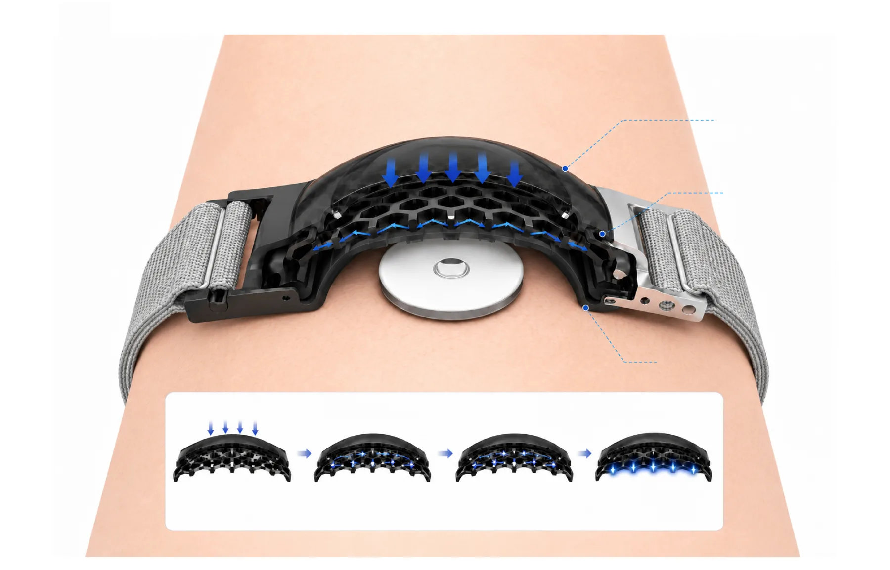 Cutaway view showing the honeycomb structure dispersing impact force above the CGM sensor